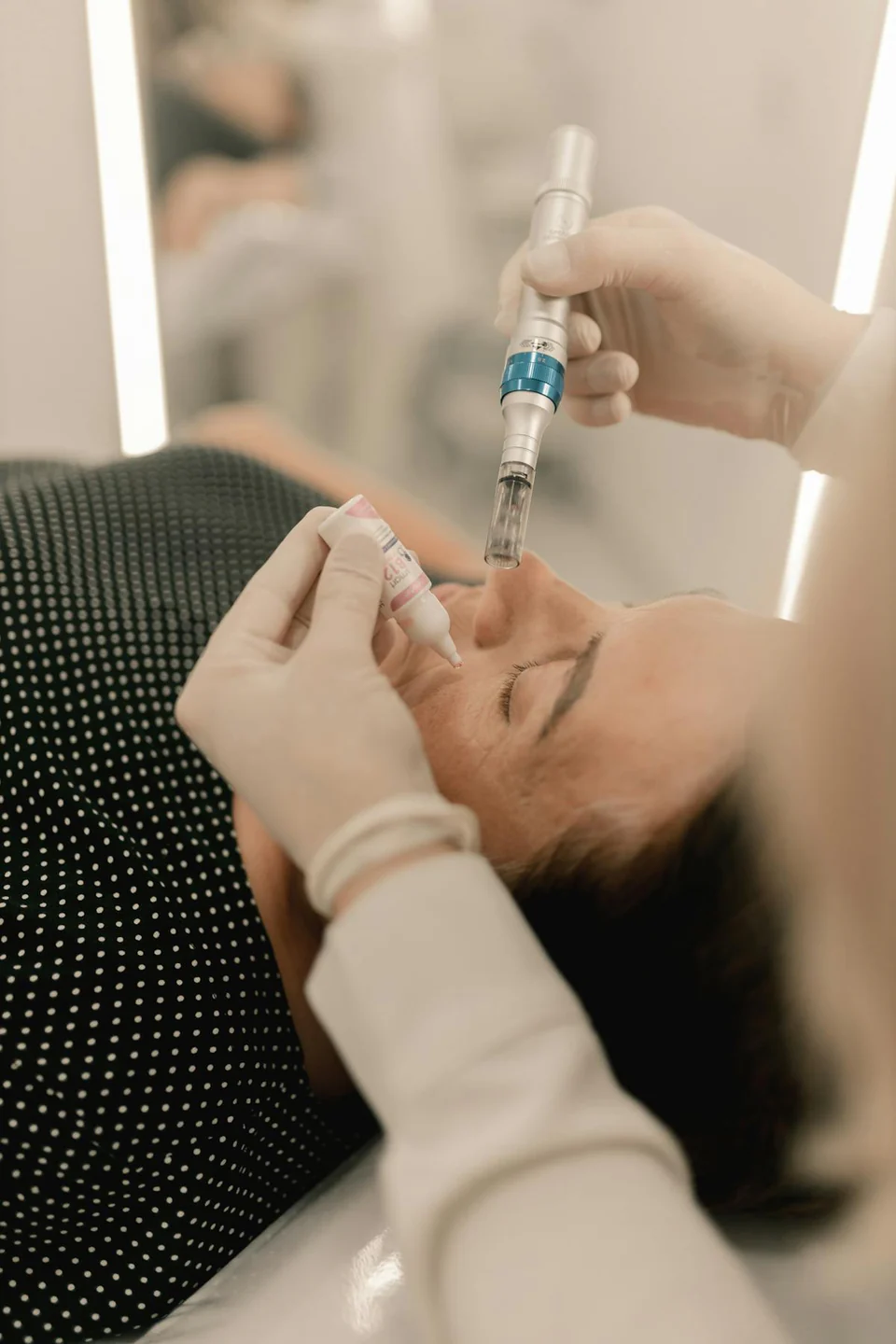 Microneedling service