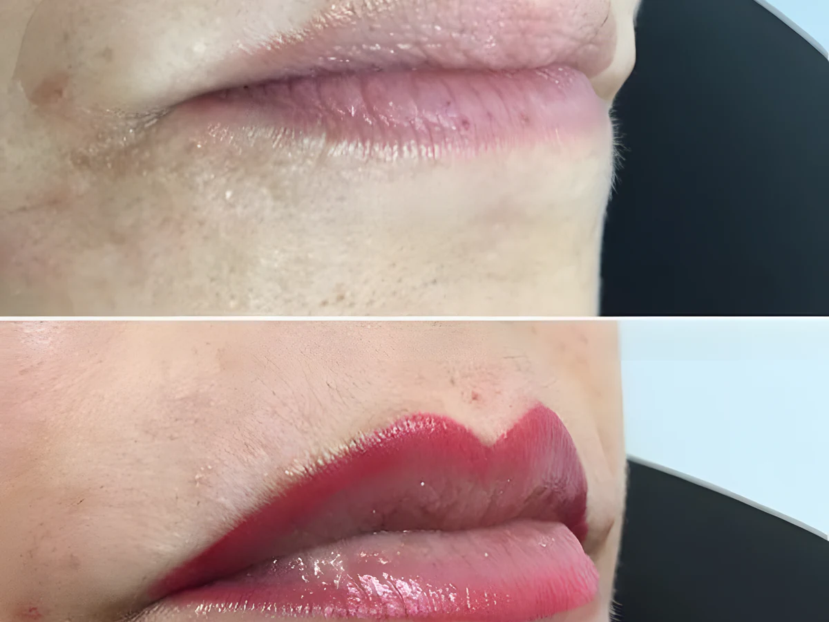 Lip Tattoo Touch-Up at Shihan Beauty Clinic