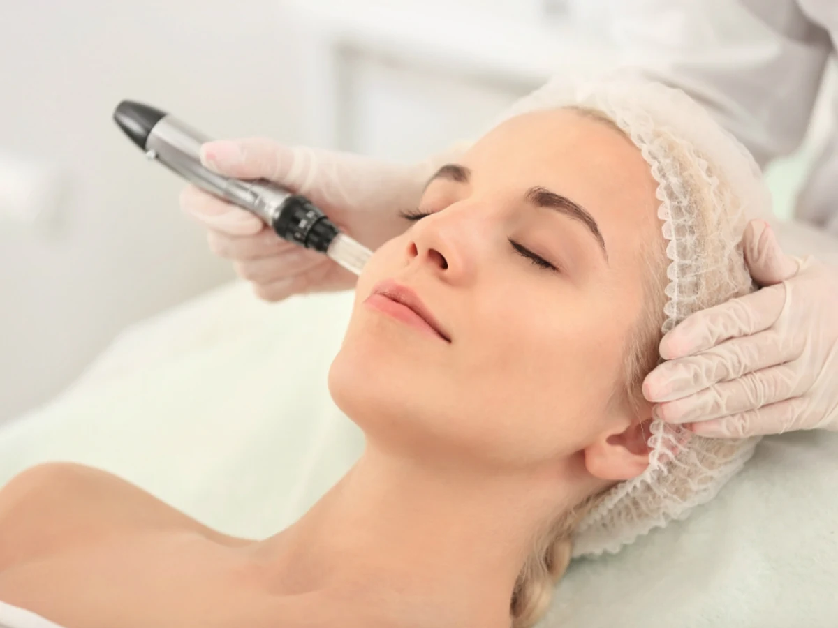 Microneedling at Shihan Beauty Clinic in Avon, Connecticut