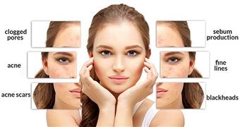 Salicylic Facial