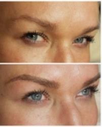 Microblading - Corrective