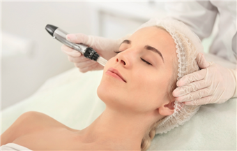 Microneedling