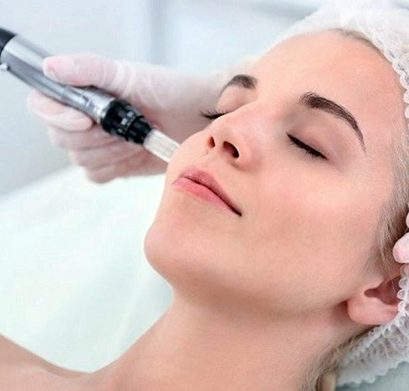 Microneedling