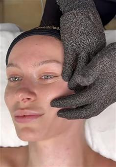 Microcurrent Facial